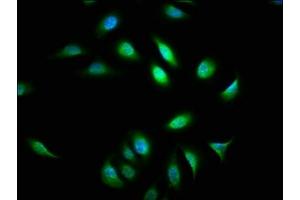 Immunofluorescence staining of A549 cells with ABIN7144797 at 1:133, counter-stained with DAPI. (ATXN7 anticorps  (AA 402-503))