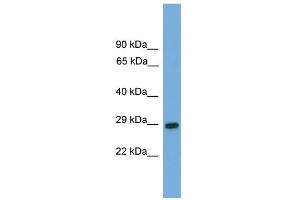WB Suggested Anti-RGS19 Antibody Titration: 0. (RGS19 anticorps  (N-Term))