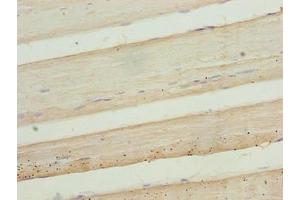 Immunohistochemistry of paraffin-embedded human skeletal muscle tissue using ABIN7148227 at dilution of 1:100