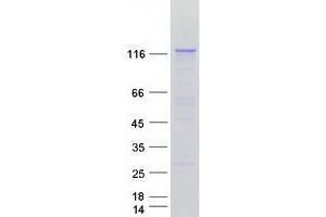 Validation with Western Blot