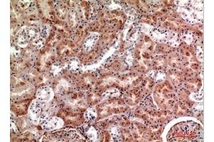 Immunohistochemical analysis of paraffin-embedded human-kidney, antibody was diluted at 1:100. (M-CSF/CSF1 anticorps  (C-Term))