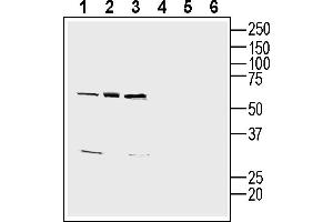 Western blot analysis of human  monocytic leukemia cell line lysates (lanes 1 and 4), human  megakaryoblast cell line lysate (lanes 2 and 5) and human LNCaP prostate adenocarcinoma cell line lysate (lanes 3 and 6):1-3. (CD9 anticorps  (Extracellular))