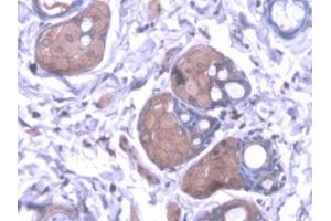 Detection of KMO in Rat Skin Tissue using Polyclonal Antibody to Kynurenine-3-Monooxygenase (KMO)