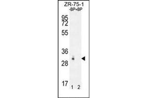 Western blot analysis of RAB40AL Antibdy (N-term) Cat. (RAB40AL anticorps  (N-Term))