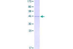 Image no. 1 for Proline Rich 13 (PRR13) (AA 1-148) protein (GST tag) (ABIN1316428)