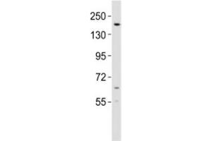 Western blot testing of KDM6B antibody at 1:2000 dilution + mouse lung lysate
