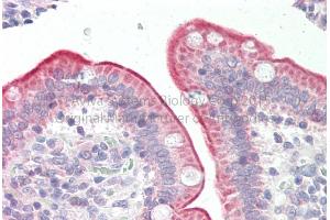 Rabbit Anti-PLSCR1 Antibody Catalog Number: ARP71391 Formalin Fixed Paraffin Embedded Tissue: Human Adult Small intestine  Observed Staining: Cytoplasm in hepatocytes Primary Antibody Concentration: 1:600 Secondary Antibody: Donkey anti-Rabbit-Cy3 Secondary Antibody Concentration: 1:200 Magnification: 20X Exposure Time: 0.