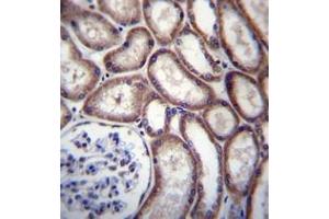 Formalin fixed and paraffin embedded human kidney tissue reacted with DNAJC27 / RBJ Antibody (N-term) followed by peroxidase conjugation of the secondary antibody and DAB staining.