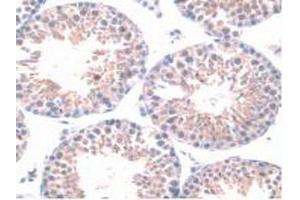 Detection of HPSE in Mouse Testis Tissue using Polyclonal Antibody to Heparanase (HPSE) (HPSE anticorps  (AA 280-412))