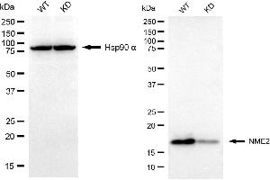 Western blotting analysis using NME2 antibody (ABIN7799681).