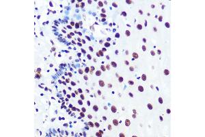 Immunohistochemistry of paraffin-embedded human esophageal using P Rabbit mAb (ABIN7269445) at dilution of 1:100 (40x lens). (PABPN1 anticorps)