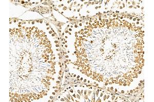 ABIN7094737 and ABIN7098788 at 1/100 staining Rat testis tissue by IHC-P.