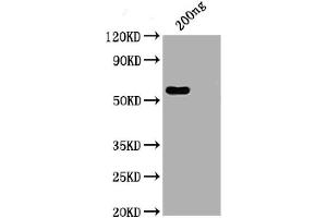 WB of recombinant SARS-CoV-2 Nucleocapsid antibody (ABIN6952664) (Recombinant SARS-CoV-2 Nucleocapsid anticorps  (AA 1-419))