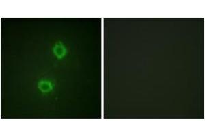 Immunofluorescence analysis of HuvEc cells, using FGFR1 (Ab-654) Antibody. (FGFR1 anticorps  (AA 626-675))