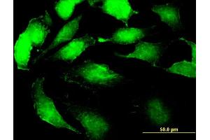 Immunofluorescence of monoclonal antibody to SSR2 on HeLa cell.