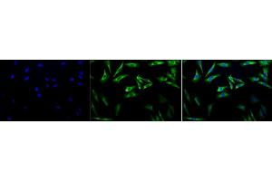 Immunocytochemistry/Immunofluorescence analysis using Mouse Anti-Hsp27 Monoclonal Antibody, Clone 5D12-A3 (ABIN361649 and ABIN361650).