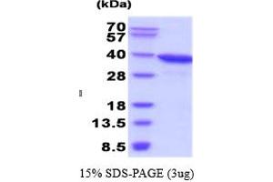 SDS-PAGE (SDS) image for Aldo-Keto Reductase Family 1, Member C3 (3-alpha Hydroxysteroid Dehydrogenase, Type II) (AKR1C3) (AA 1-323) (Active) protein (ABIN6387733)