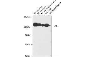 Western blot analysis of extracts of various cell lines using ZAK Polyclonal Antibody at dilution of 1:3000. (ZAK anticorps)