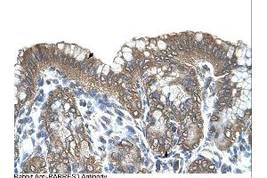 RARRES3 antibody was used for immunohistochemistry at a concentration of 4-8 ug/ml. (RARRES3 anticorps)