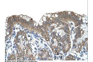 RARRES3 antibody was used for immunohistochemistry at a concentration of 4-8 ug/ml.