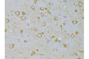 Immunohistochemistry of paraffin-embedded rat brain using TSHR Antibody.