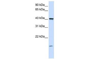 Western Blotting (WB) image for anti-Transmembrane Protein 79 (TMEM79) antibody (ABIN2459356) (TMEM79 anticorps)
