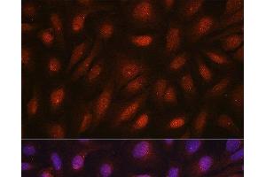 Immunofluorescence analysis of U2OS cells using CETN3 Polyclonal Antibody at dilution of 1:100.