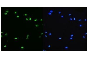 IF analysis of PTBP1 using anti-PTBP1 antibody (ABIN7599450). (PTBP1 anticorps  (AA 1-504))