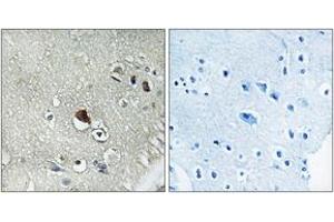 Immunohistochemistry analysis of paraffin-embedded human brain tissue, using DVL3 Antibody. (DVL3 anticorps  (AA 326-375))