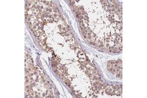 Immunohistochemical staining of human testis with UBXN6 polyclonal antibody  shows strong cytoplasmic positivity in spermatids. (UBXN6 anticorps)