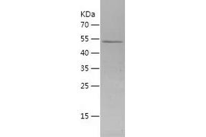 Western Blotting (WB) image for SMAD, Mothers Against DPP Homolog 5 (SMAD5) (AA 186-465) protein (His-IF2DI Tag) (ABIN7125124)