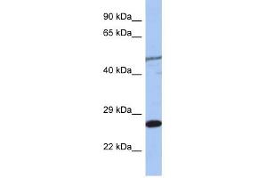 MIS12 antibody used at 1 ug/ml to detect target protein. (MIS12 anticorps)