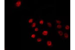 ABIN6266812 staining 293 by IF/ICC. (ELF1 anticorps  (C-Term))