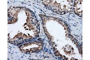 Immunohistochemical staining of paraffin-embedded liver tissue using anti-PSMC3mouse monoclonal antibody. (PSMC3 anticorps)