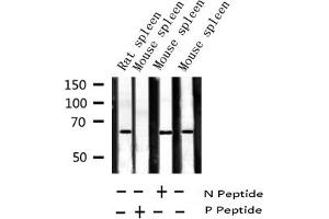 Western blot analysis of Phospho-ZAP-70 (Tyr319) expression in various lysates