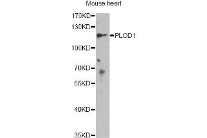 Western blot analysis of extracts of mouse heart, using PLOD1 antibody (ABIN6289945) at 1:1000 dilution. (PLOD1 anticorps)