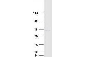 Validation with Western Blot