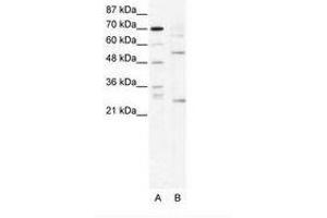Image no. 1 for anti-T-Cell Acute Lymphocytic Leukemia 1 (TAL1) (AA 236-285) antibody (ABIN202266) (TAL1 anticorps  (AA 236-285))