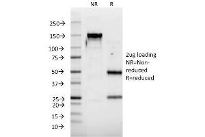 SDS-PAGE Analysis Purified IFNA2 Mouse Monoclonal Antibody (N39).