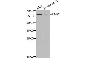 Western blot analysis of extracts of various cell lines, using BNIP3 Antibody (ABIN5973321) at 1/1000 dilution. (BNIP3 anticorps)
