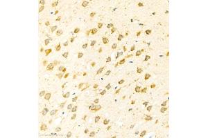 Immunohistochemistry of paraffin embedded mouse brain using eIF5A2 (ABIN7073893) at dilution of 1:300 (400x lens)