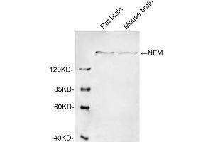 Western blot analysis of cell lysates using 1 µg/mL Rabbit Anti-Neurofilament-M Polyclonal Antibody (ABIN398865) The signal was developed with IRDyeTM 800 Conjugated Goat Anti-Rabbit IgG.