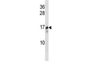 TRAPPC2 antibody western blot analysis in NCI-H292 lysate. (TRAPPC2 anticorps  (AA 11-39))