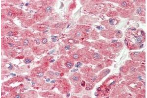 Human Heart: Formalin-Fixed, Paraffin-Embedded (FFPE)