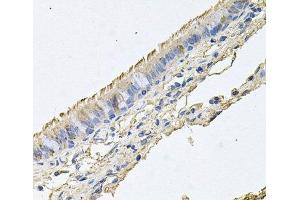 Immunohistochemistry of paraffin-embedded Human trachea using EPOR Polyclonal Antibody at dilution of 1:100 (40x lens). (EPOR anticorps)