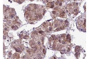 ABIN6267593 at 1/100 staining human liver tissue sections by IHC-P. (MEK1 anticorps  (pSer217))