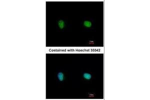 ICC/IF Image Immunofluorescence analysis of paraformaldehyde-fixed HeLa, using Ku70, antibody at 1:500 dilution. (XRCC6 anticorps)