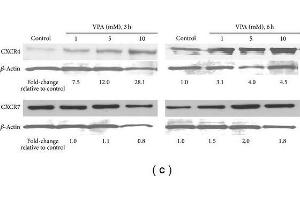 VPA increases CXCR4 and CXCR7 gene and protein expression.
