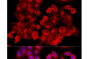 Immunofluorescence analysis of HeLa cells using CLTC Polyclonal Antibody at dilution of 1:100 (40x lens). (Clathrin Heavy Chain (CLTC) anticorps)