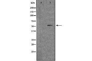 Western blot analysis of extracts from COLO cells, using OPN4 antibody. (OPN4 anticorps  (C-Term))